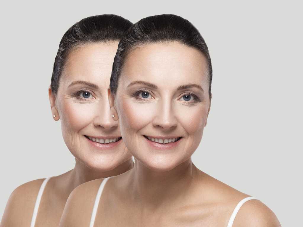 Skin Rejuvenation Treatment in Siliguri