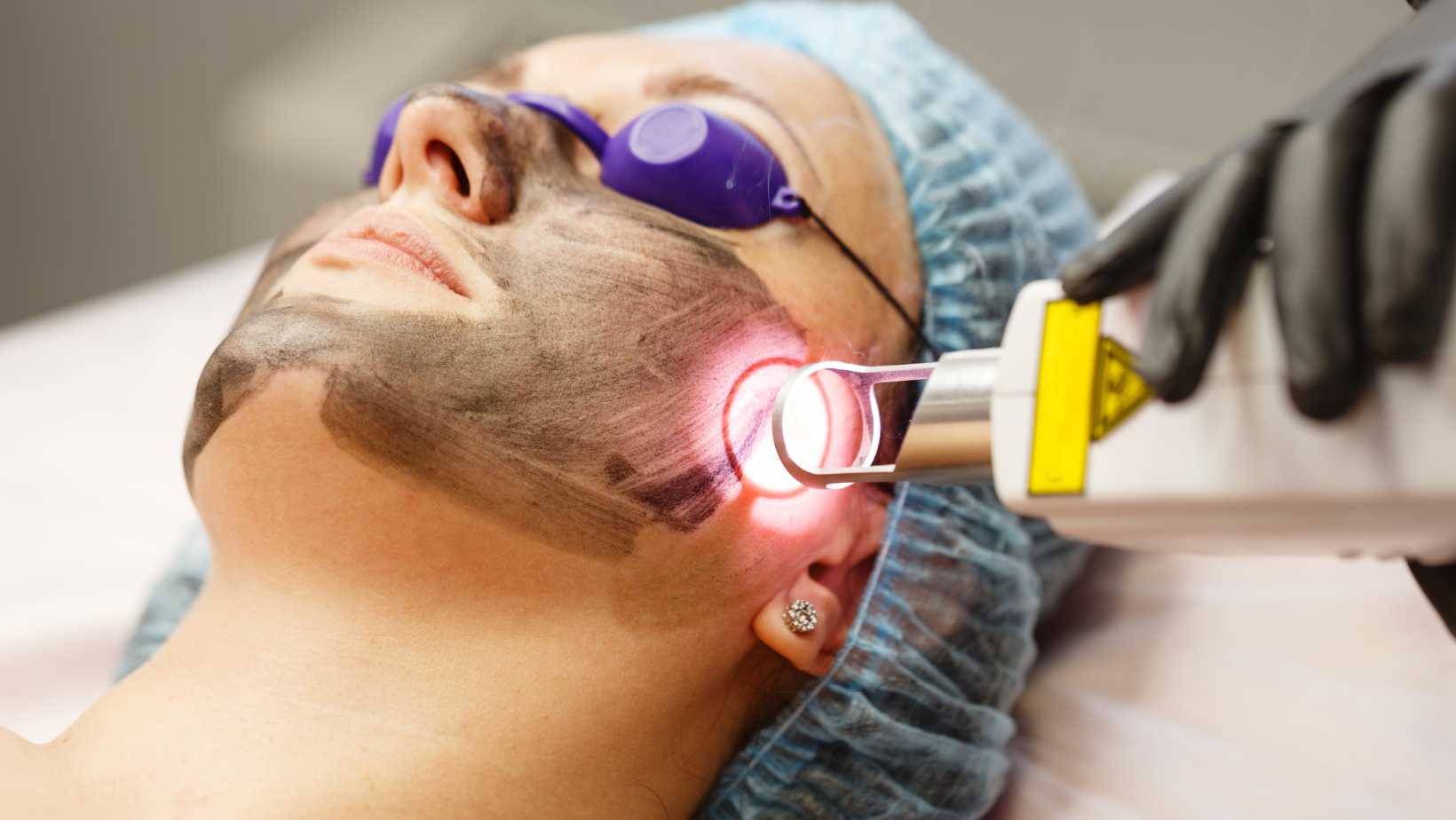 Laser Treatment in Siliguri