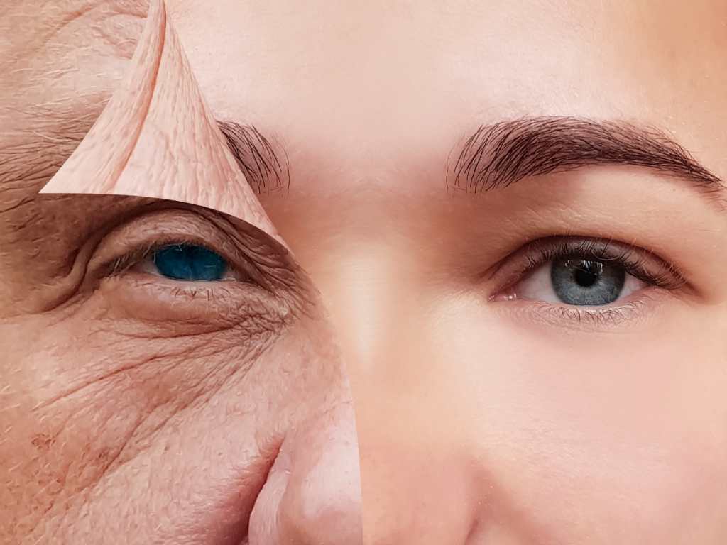 Anti Aging Treatment in Siliguri